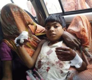 the 12 year old in the previous blast. Both kids had grievous injuries