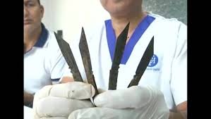 Cop swallowed 40 knives, survived!